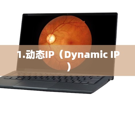 1.动态IP（Dynamic IP）